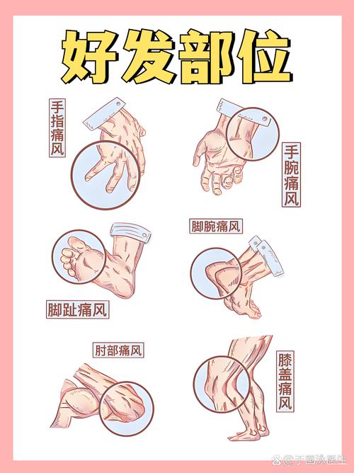 痛风泡什么喝效果最好