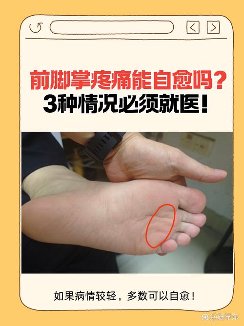 脚底痛风是怎么引起的