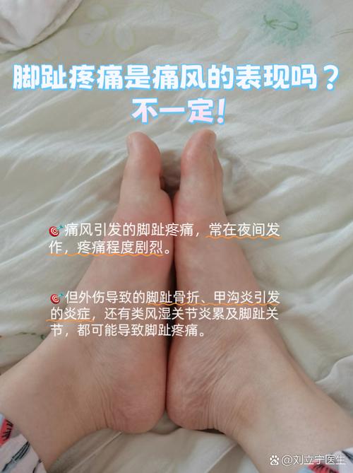 脚痛风应该注意些什么