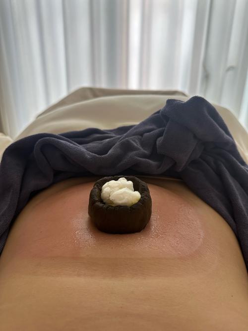 医院可以针灸丰胸吗