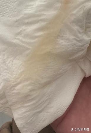 安全期有白带是排卵吗