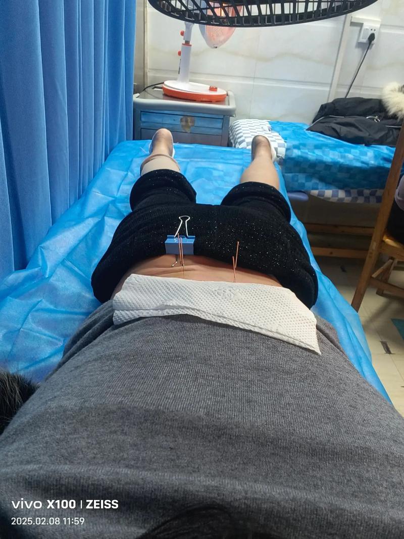 厦门哪里可以学针灸