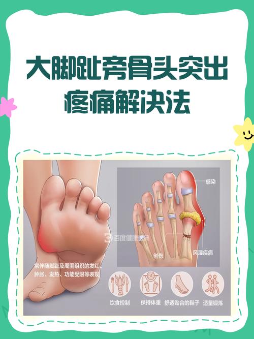 脚大拇指痛风治疗方法