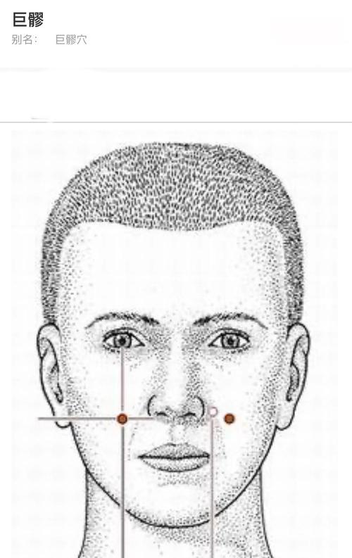 脸上长痘痘针灸穴位