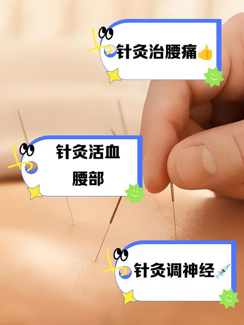 针灸减肥天天扎好吗