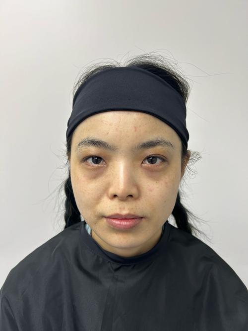 3d包裹祛眼袋安全吗