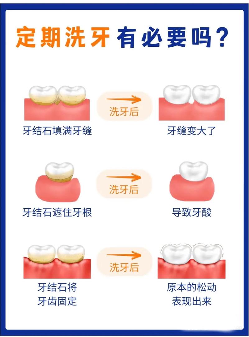 小牙科诊所洗牙安全吗