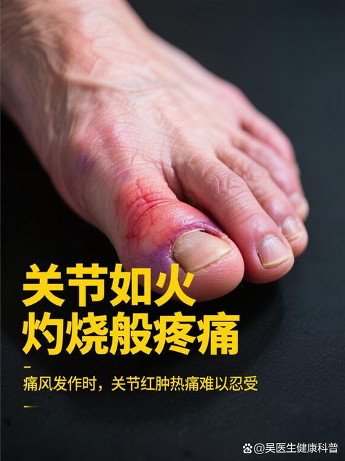 痛风关节消肿后还是疼