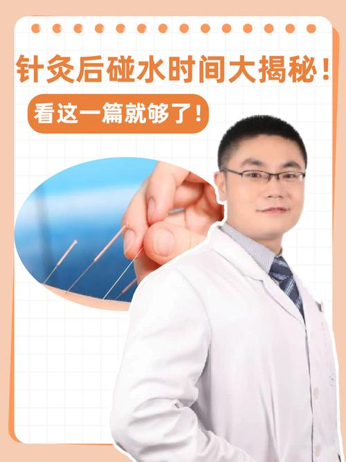 酒后多久才能做针灸