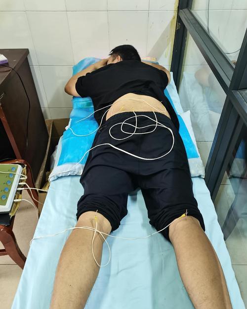 寒湿腰痛的针灸治疗