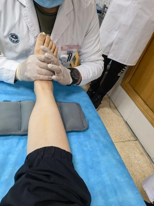 踝关节疼痛针灸图片