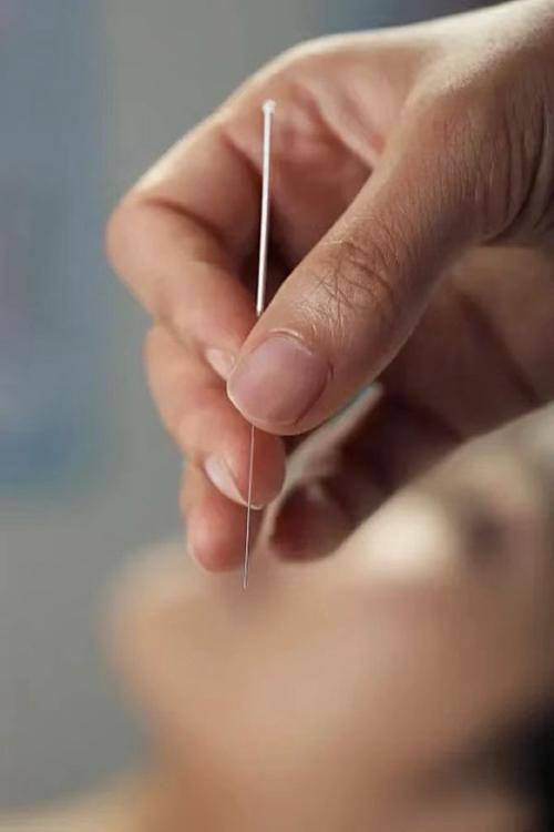 汤立新针灸视频全集