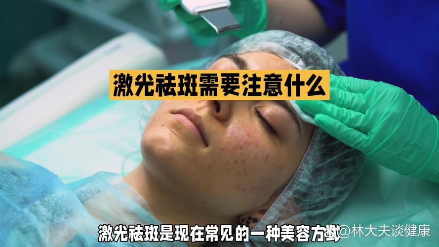 激光去除黑色素安全吗