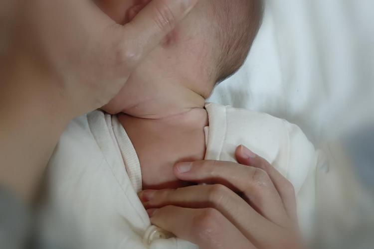 婴儿斜颈针灸管用吗