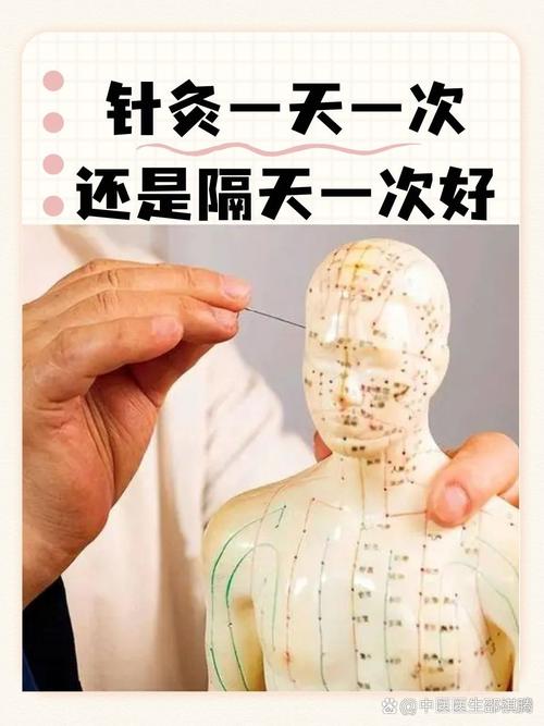 气血不通可以针灸吗