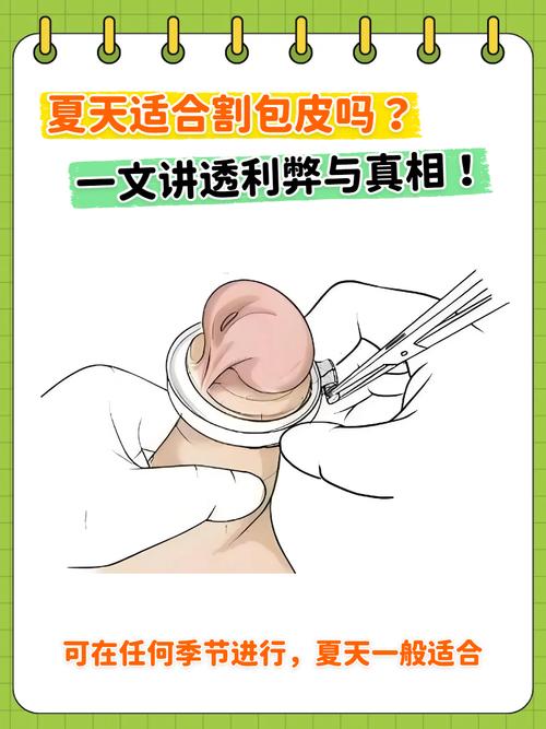 重庆割包皮男健最安全