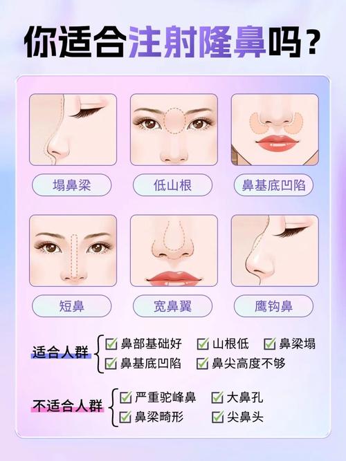 注射隆鼻安全性怎么样