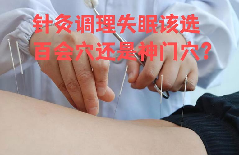 孕期失眠可以针灸吗