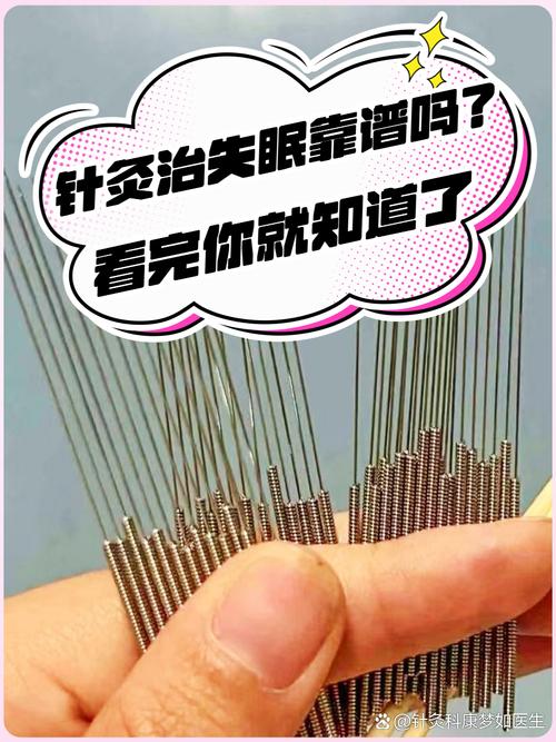 孕期失眠可以针灸吗