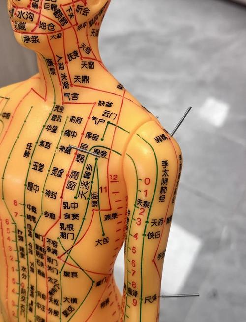 哪里可以正规学针灸