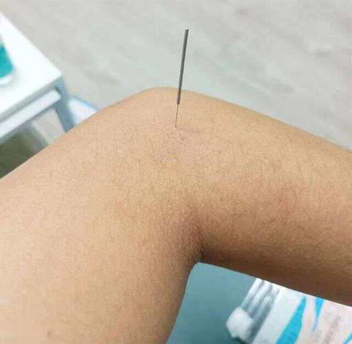 针灸按摩治疗高血压