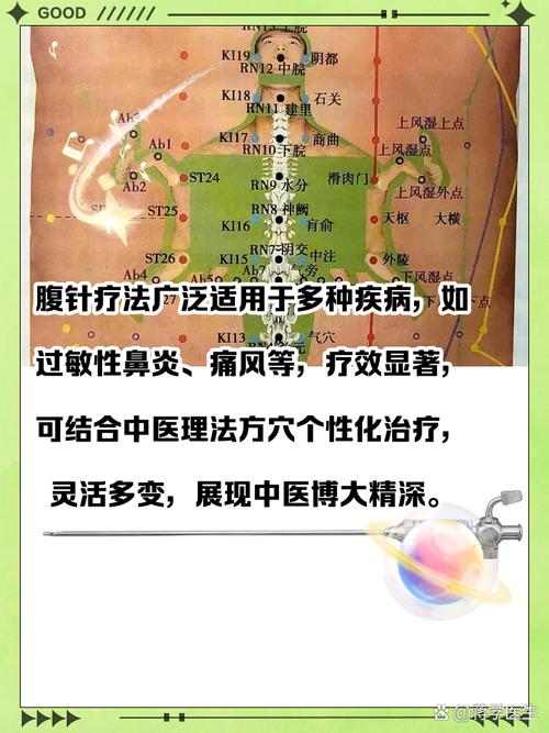 胃肠功能紊乱 针灸