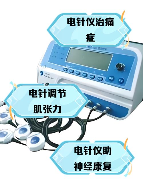 电子针灸原理是什么