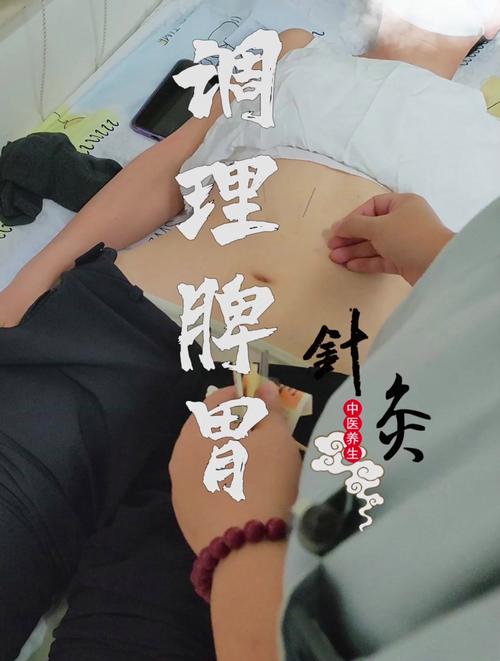 脾虚体湿 针灸效果