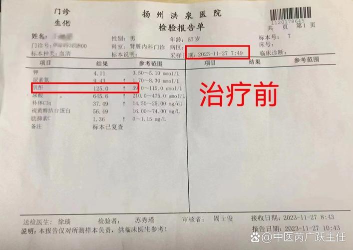 痛风确诊需要化验什么