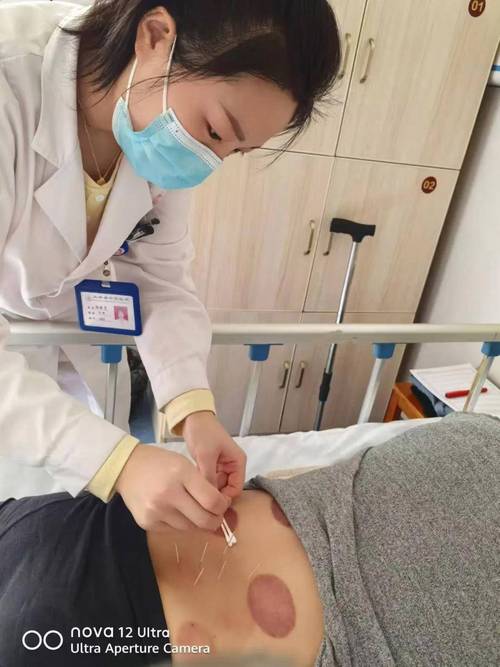 针灸套管针进针视频