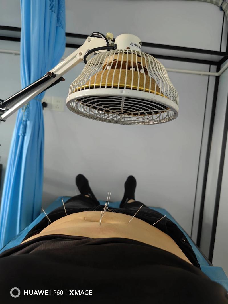 湘潭哪里有正规针灸