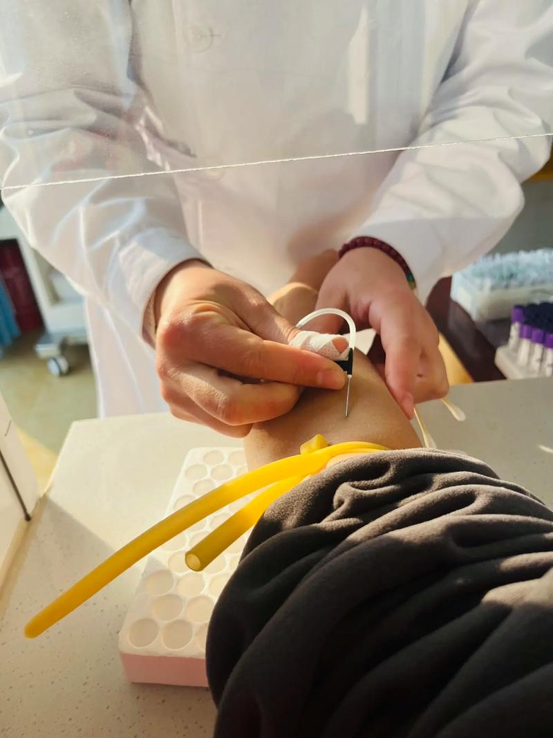 天津一附属针灸减肥