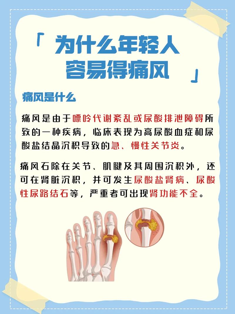 尿酸500多是痛风吗