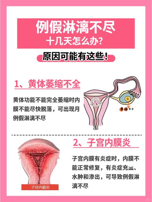 安全期有血丝怎么回事