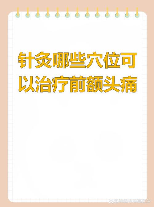 神经头痛可以针灸吗