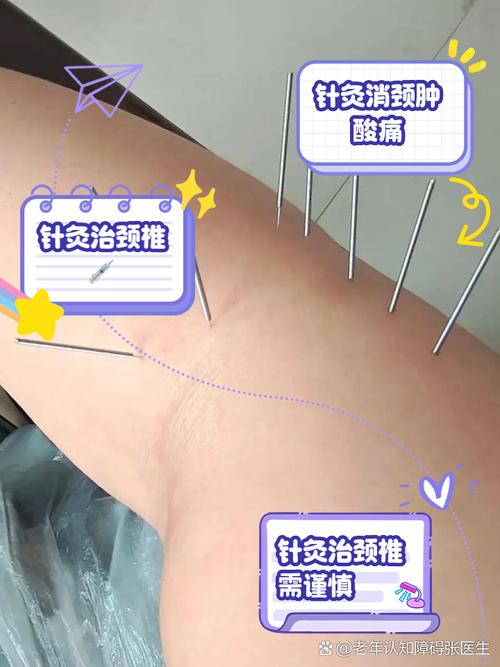 针灸 颈椎病 原理