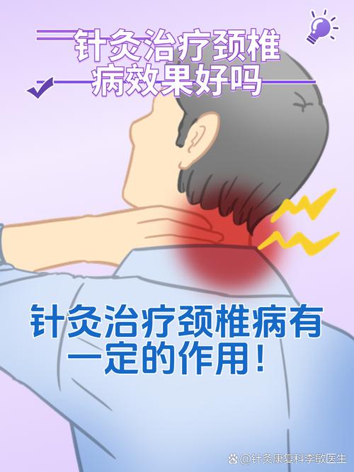 针灸 颈椎病 原理