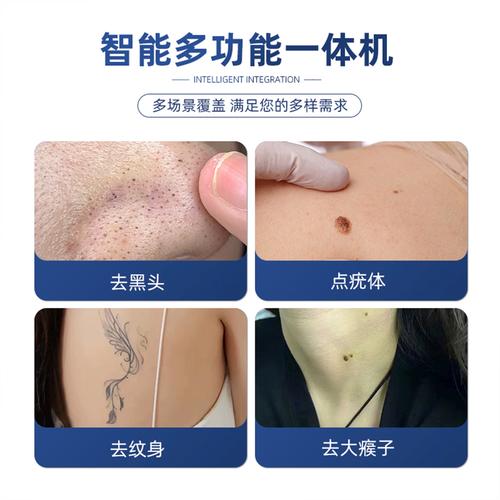 小白点痣祛斑笔安全吗