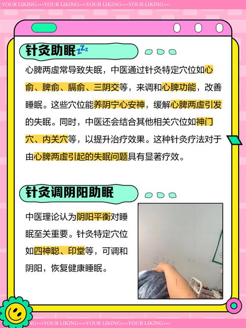 针灸可以帮助睡眠吗