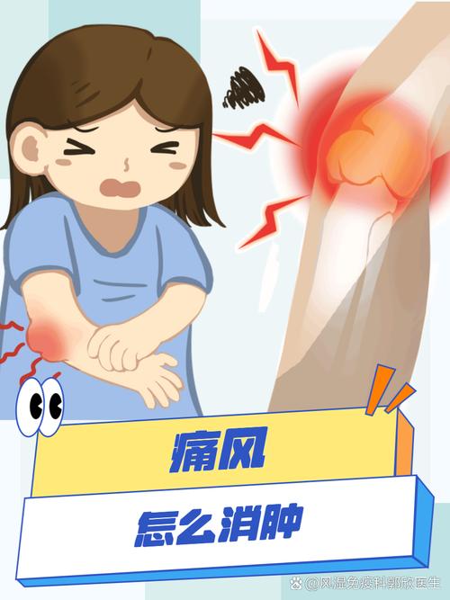 痛风一直痛还是动才痛