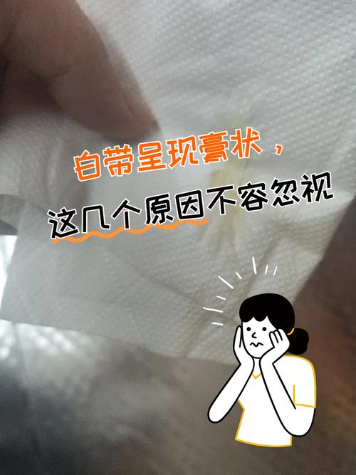 有白带的时候是安全期