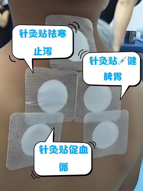 针灸膏药贴多久见效