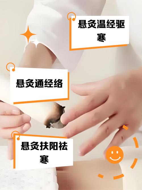 怎么样用艾灸治疗痛风