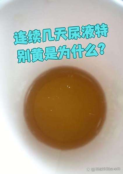 痛风小便很黄怎么回事