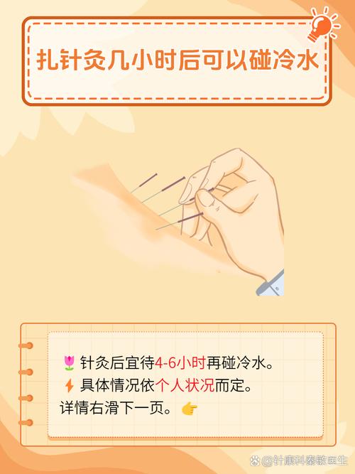 针灸减肥多久能洗澡