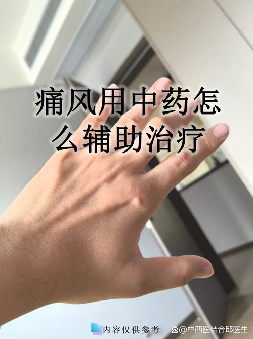 痛风的人可以喝麦片吗