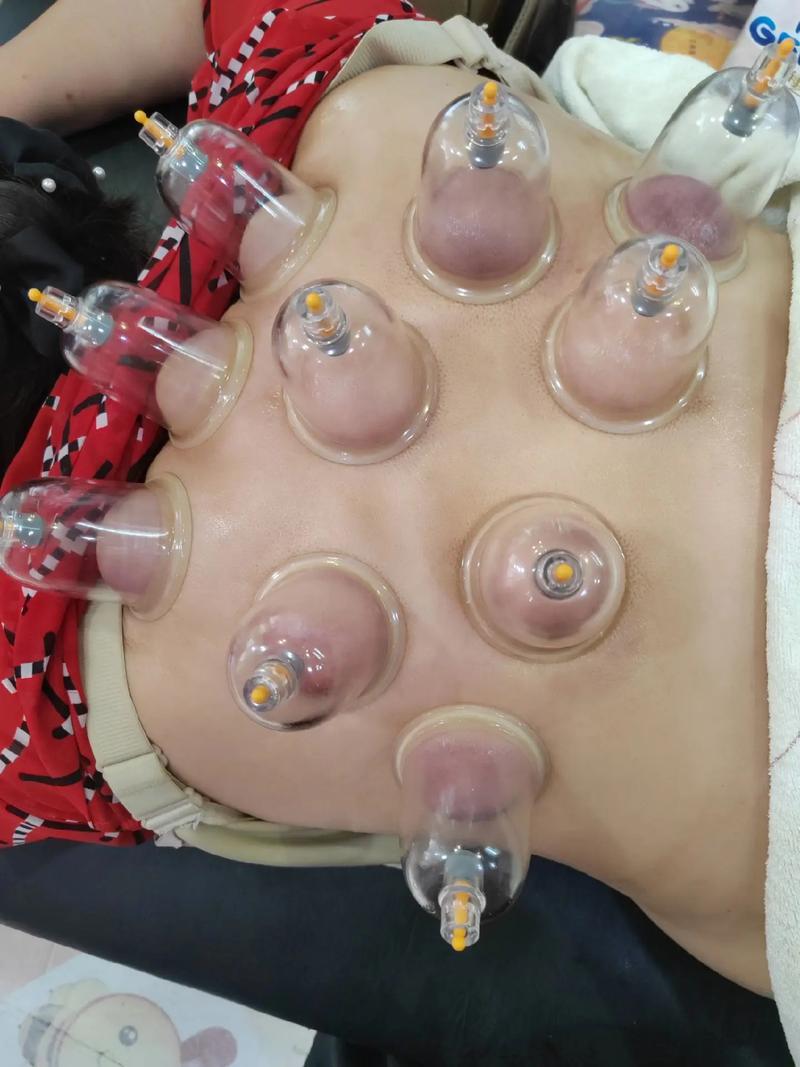 北京针灸丰胸哪里好