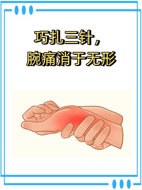 针灸手颤抖治疗方法