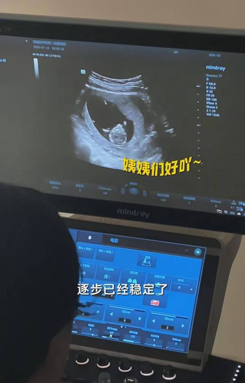 怀孕半个月打掉安全吗