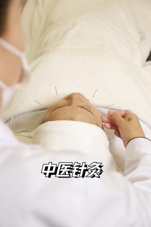 中医针灸榆次哪里好